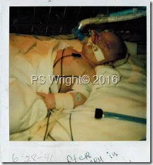 Panama in NICU 1991