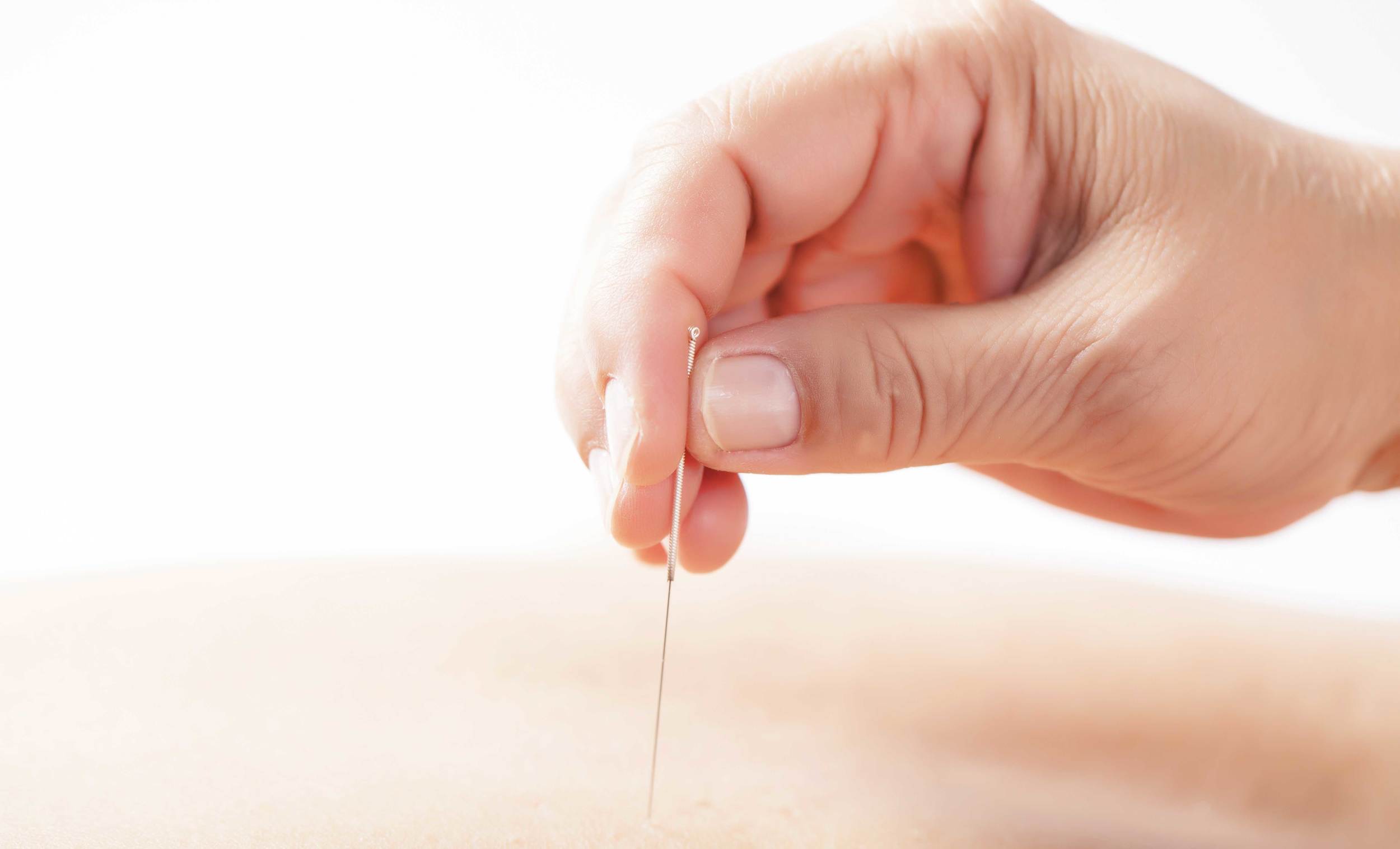 acupuncture_needle.jpg