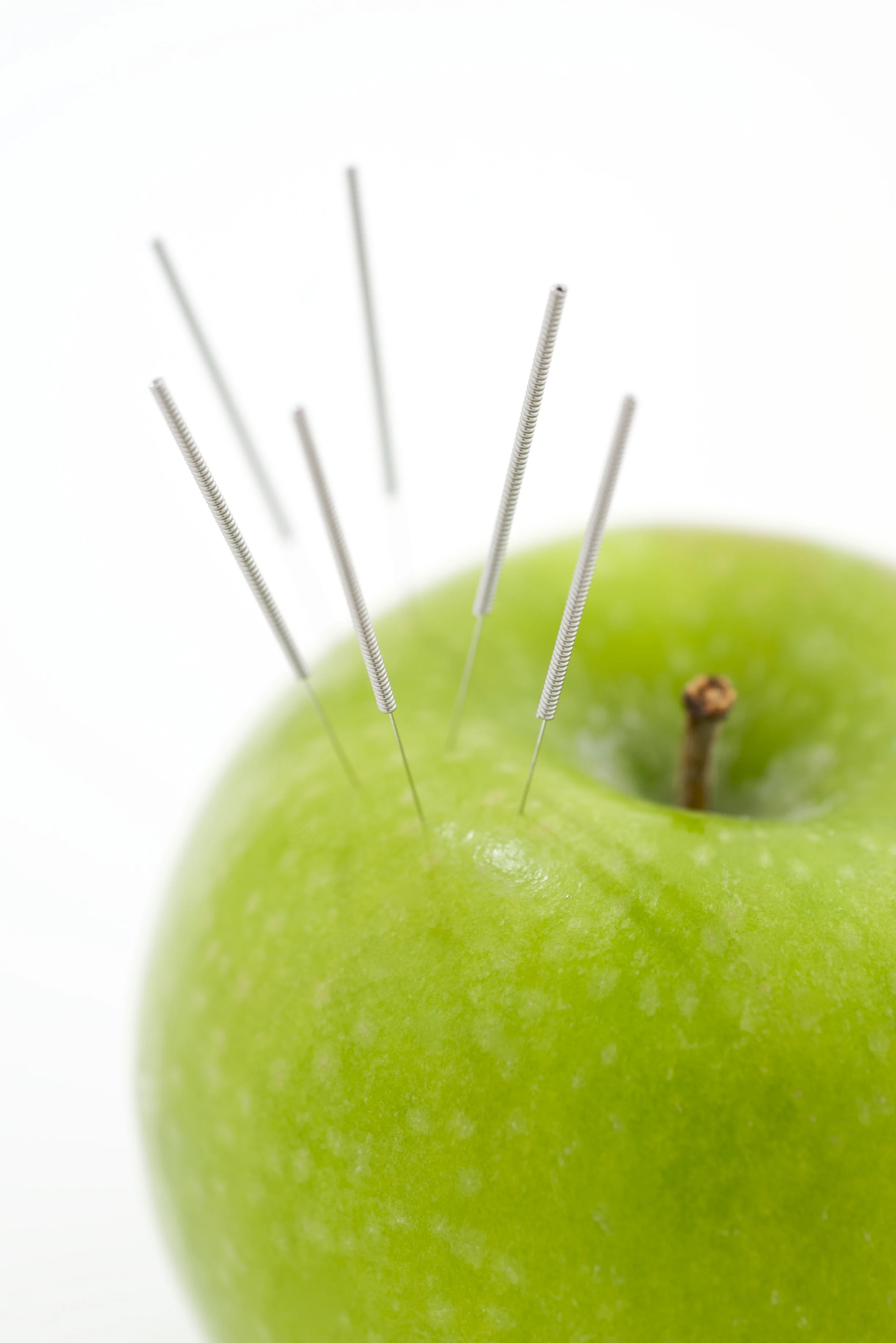 Ongoing Community Acupuncture