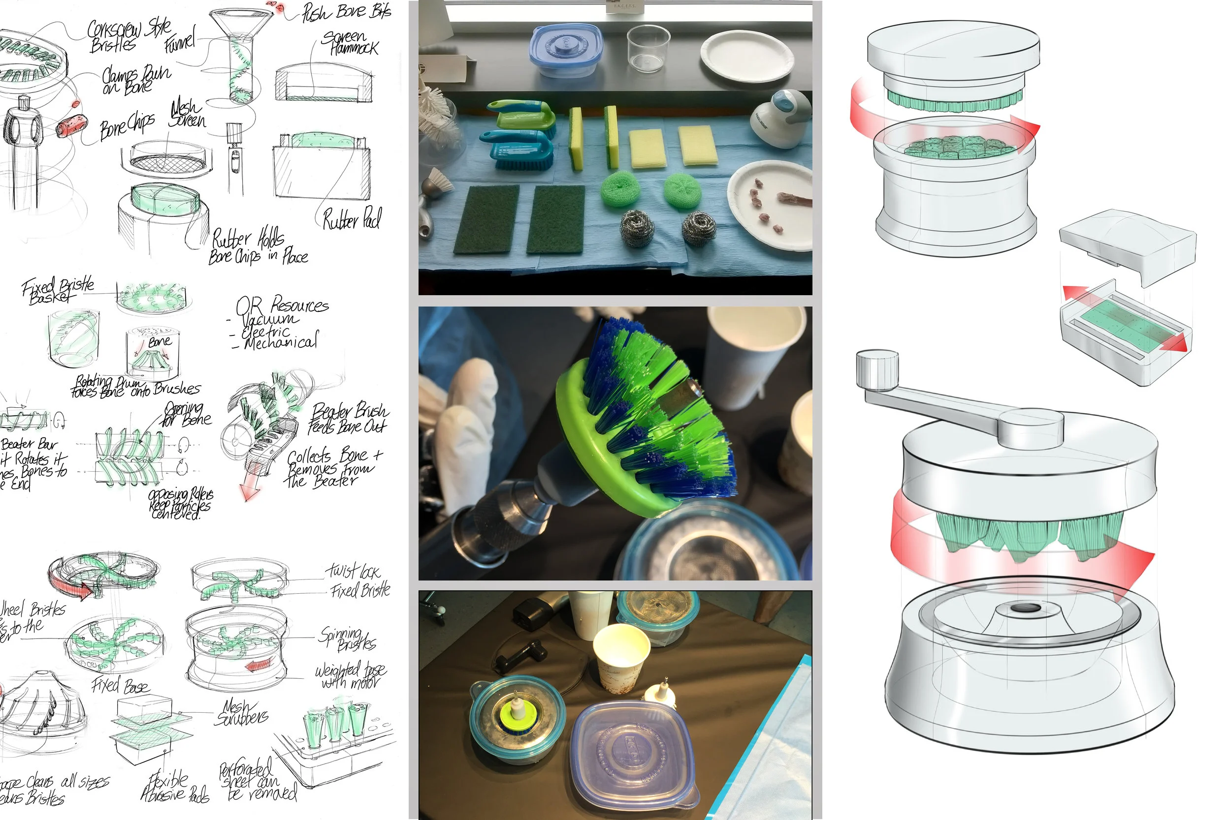 We completed several rounds of brainstorming and co-design with surgeon champions, then built and tested rough prototypes of our three top concepts.