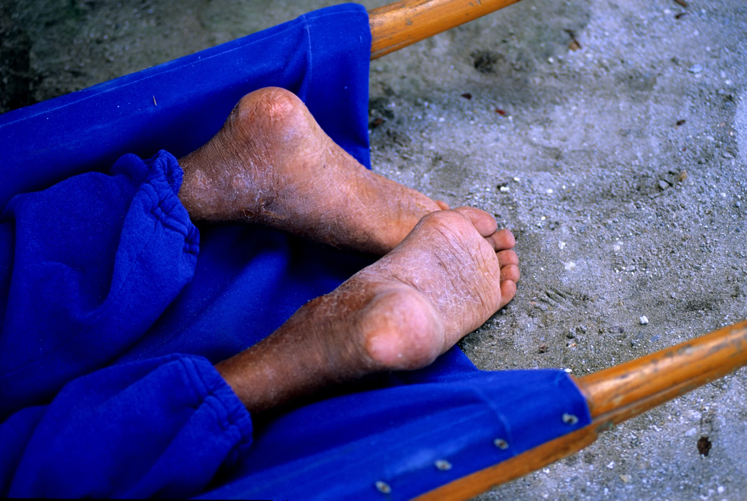 1.4.Hon.Jose'sFeet.jpg