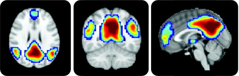 This is the default mode network — parts of your brain continuously active at rest and thought to be responsible for the “self”. 10 percent, huh?