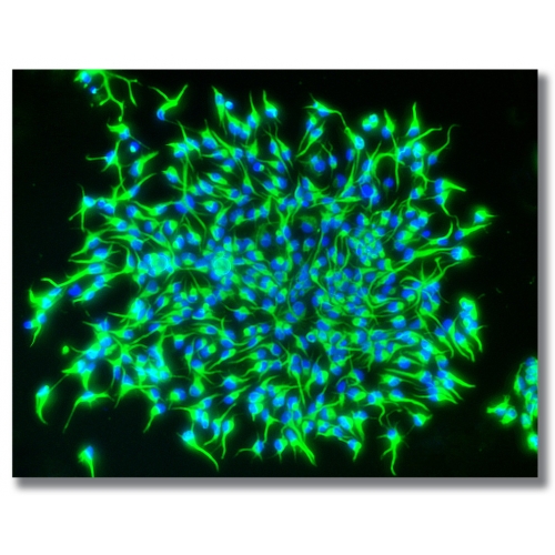 Those beautiful babies are primary rat neural stem cells as imaged with the help of fluorescent microscopy. 