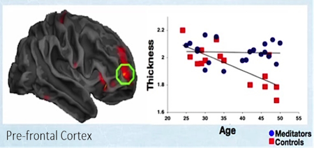 Meditators shows an increased cortical thickness in prefrontal areas which doesn't decrease with age (as it does for the control group).