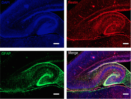 Fluorescent hippocampus. From https://www.researchgate.net/figure/237014822_fig6_Figure-8-Double-immunofluorescence-labeling-of-GFAP-and-nestin-in-the-hippocampus-from