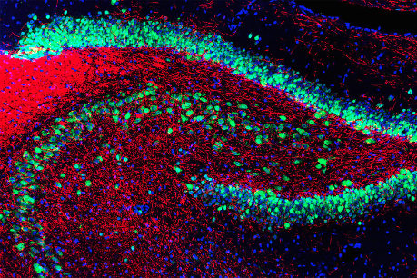 And again, a pretty hippocampus. From https://goo.gl/ZWfK18