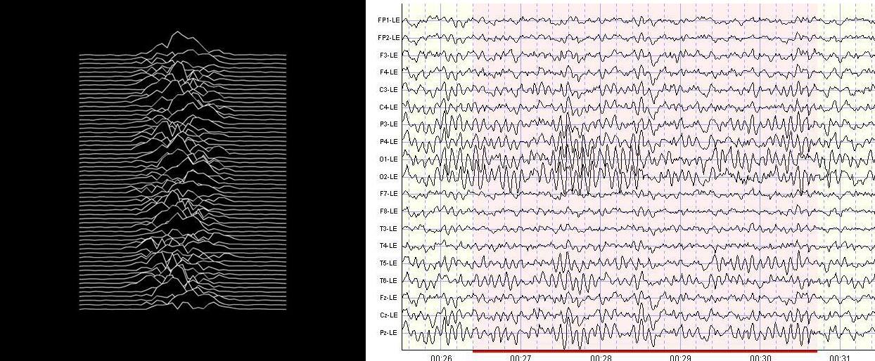 I was very disappointed to learn that Unknown Pleasures’ cover is not an EEG scan taken while listening to Love Will Tear Us Apart or something.