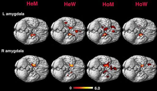 The amygdaloid connectivity in heterosexual men and women (labeled HeM and HeW) and homosexual and women (labeled HoM and HoW). One can see the similarities between straight women and gay men and straight men and gay women. From: http://www.pnas.org/content/105/27/9403.abstract