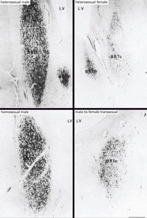 Left: BSTc of hetero- and homosexual men. Right: BSTc of women and MtF transgender. Source: https://www.ncbi.nlm.nih.gov/pubmed/7477289
