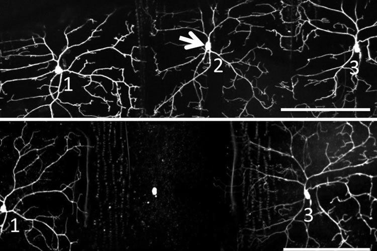 Neuron number two, before and after being shone on. Courtesy of Xiaokun Shu.