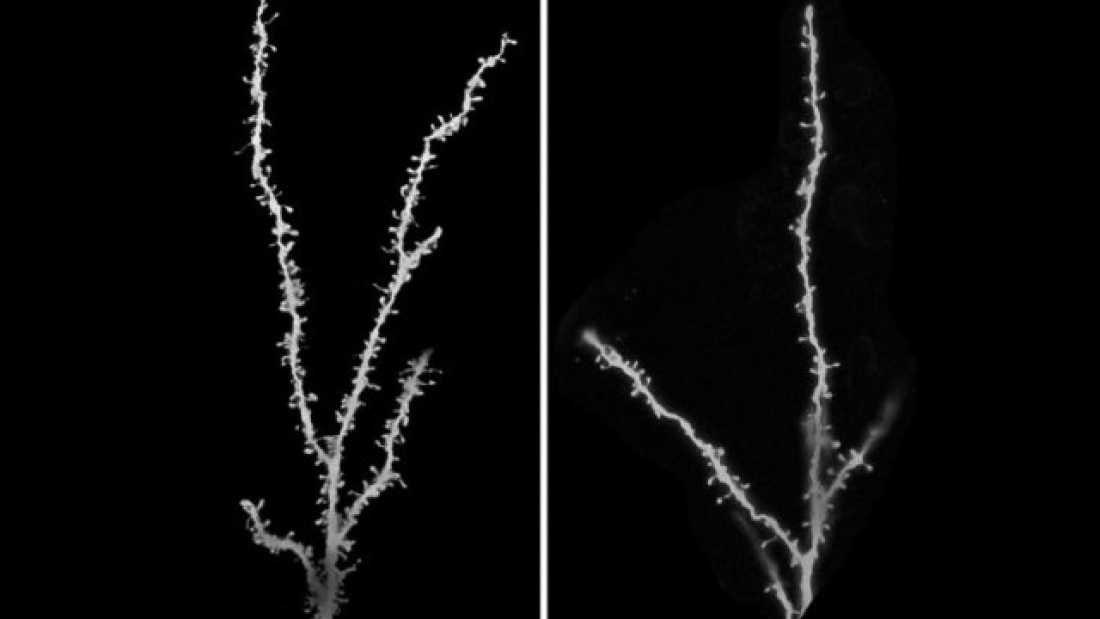 The small white blobs (=dendritic spines) are the connection sites of a neuron. Right: too many spines. Left: the autophagous protein is back in the game and the number of spines is reduced back to normal. Credit: Guomei Tang, PhD and Mark S. Sonders, PhD/Columbia University Medical Center