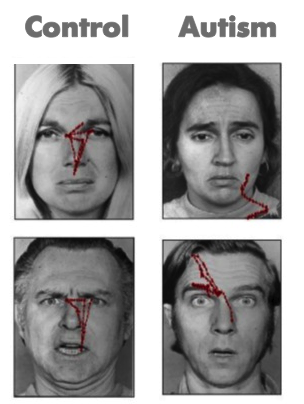 The red lines show the gaze path used by people with (right column) and without (left column) autism to explore faces. Modified from Pelphrey et al., (2002)