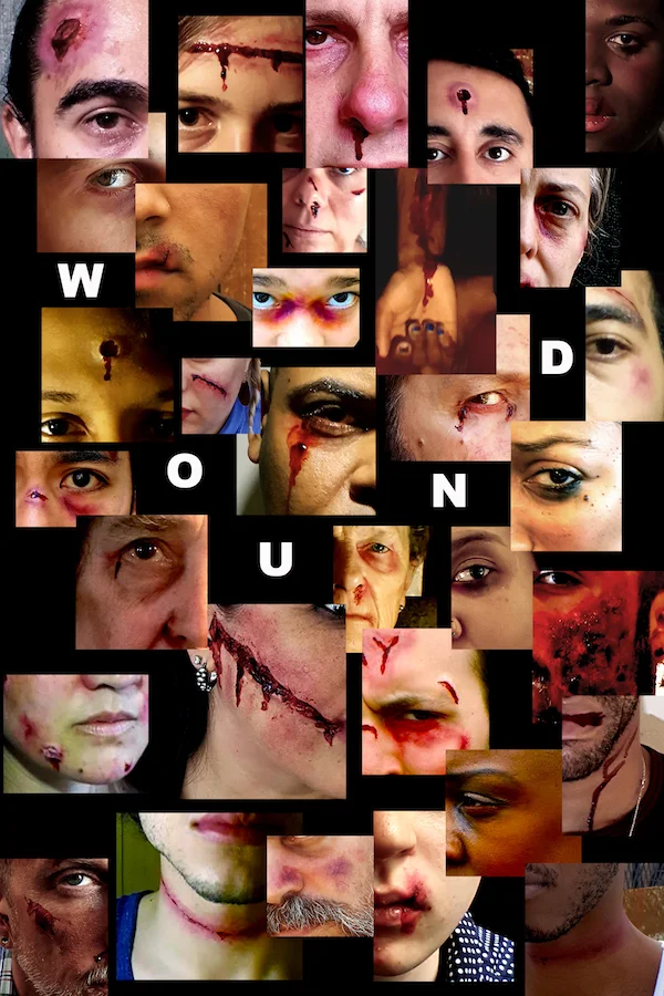 woundposter.jpg
