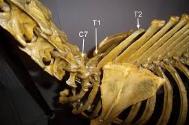 Compressions at the base of the neck (C7/T1)