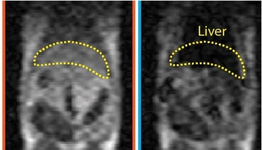  Missing piece identified for lower-cost, high-quality MRI scans: study