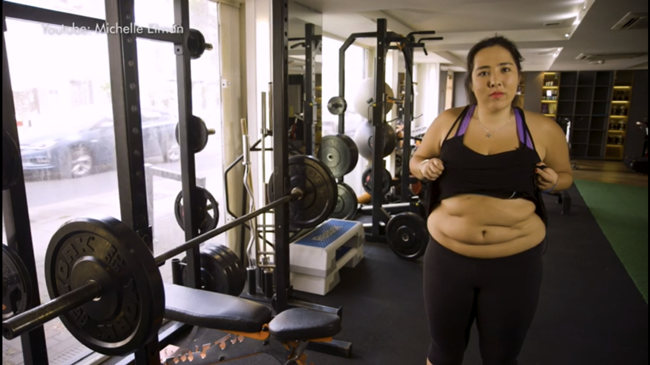 Scarred Not Scared: A Sit-Down With Michelle Elman