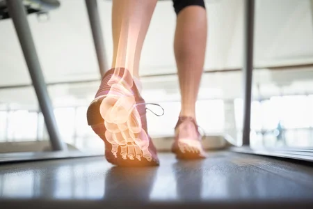 44790491_S_treadmill_bones_feet_sneakers_.jpg