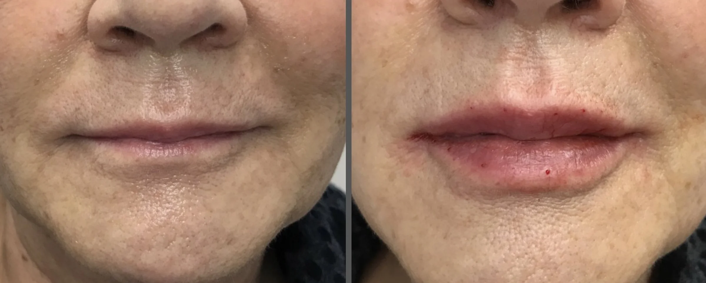 Natural Legacy Lip Hydration Treatment