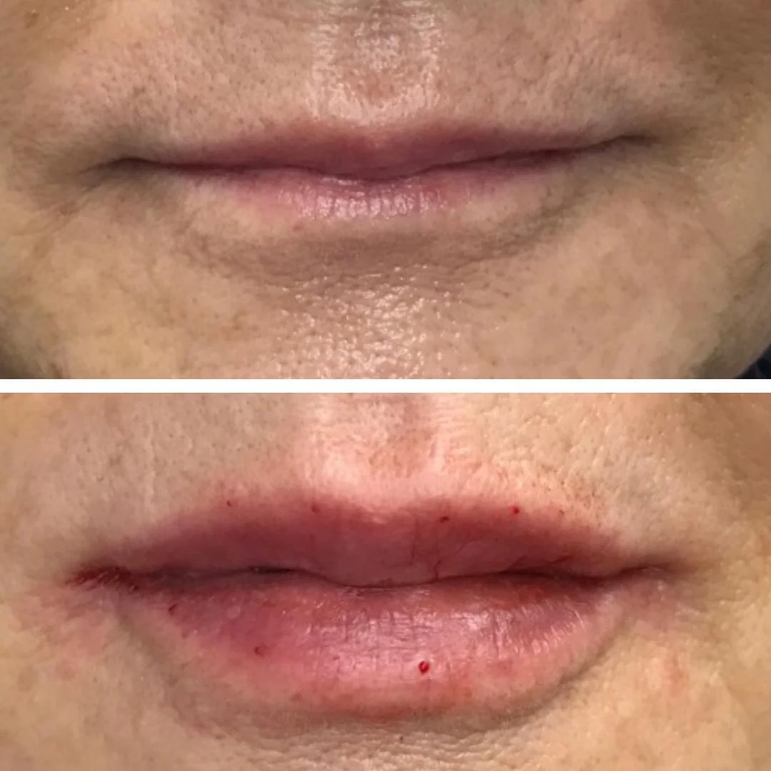 lips.jpg