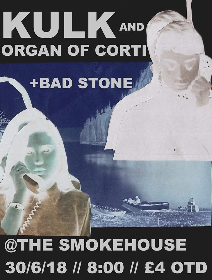 Organ of Corti support.jpg