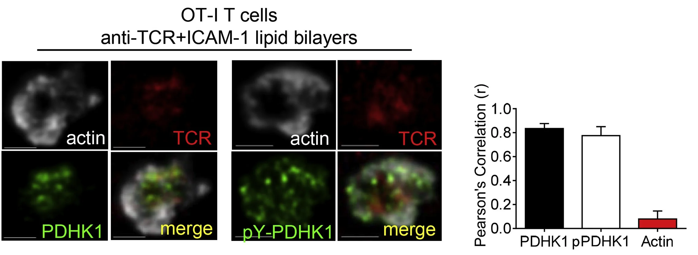 TIRF microscopy images of OT-I T cells stimulated on αTCR and ICAM-1 containing stimulatory lipid bilayers for 15 min and then stained intracellularly for total and phospho-PDHK1. From Menk et al., Cell Reports , 2018.
