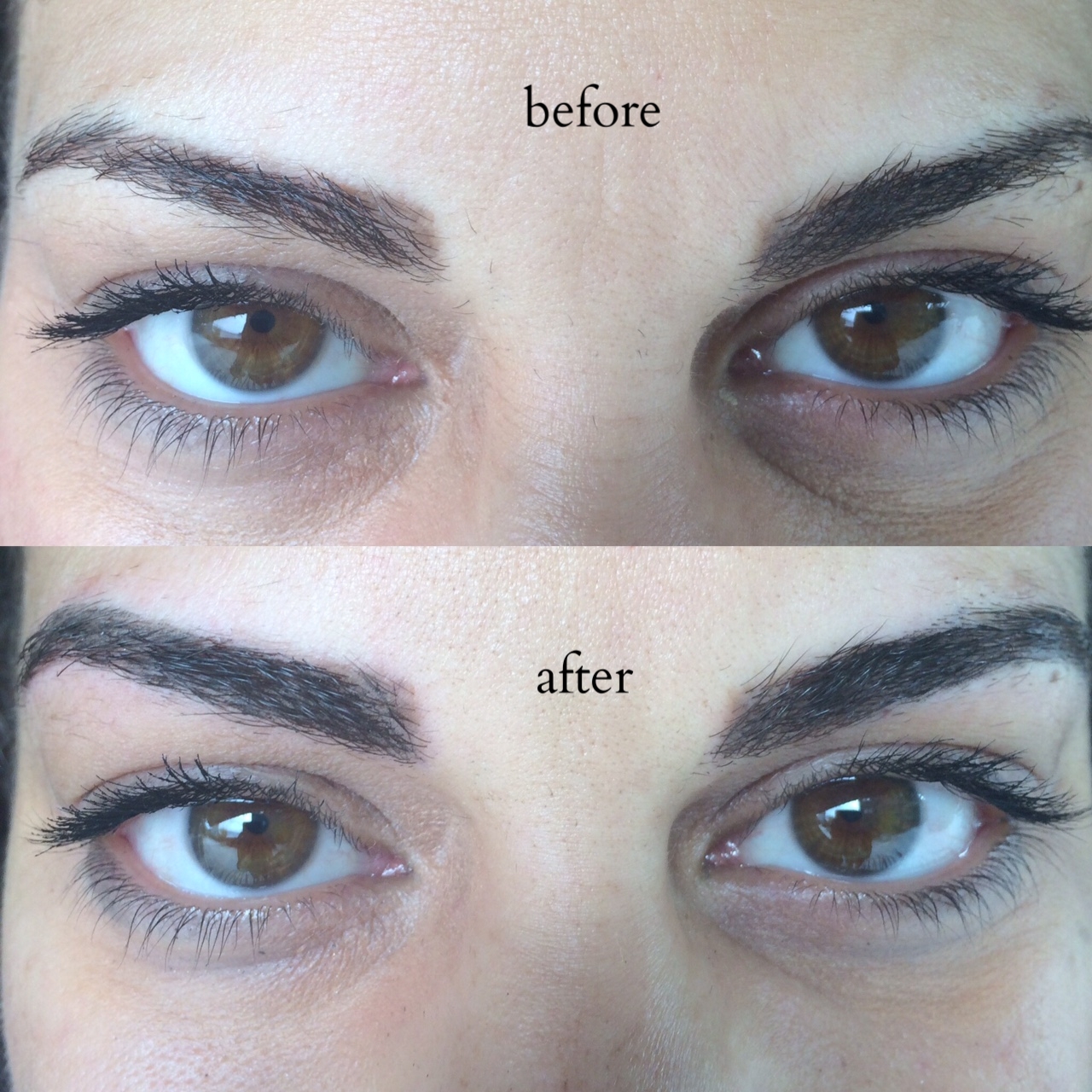 This client wanted to update old work she had done. She wants to move away from the squared off shape in front, which will naturally fade over the course of the next year. We added shape to her arch and tail and evened out her brow color during this session. Next session (second session is included in the price of the treatment) we will add hair strokes to adjust the shape in the front of the brow and perfect the look!