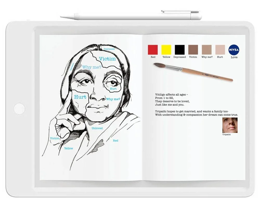 tablet-vitiligo-2_1000.jpg