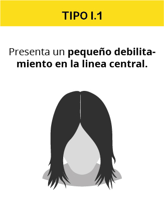 alopecia_mujeres-01.jpg