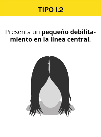 alopecia_mujeres-02.jpg