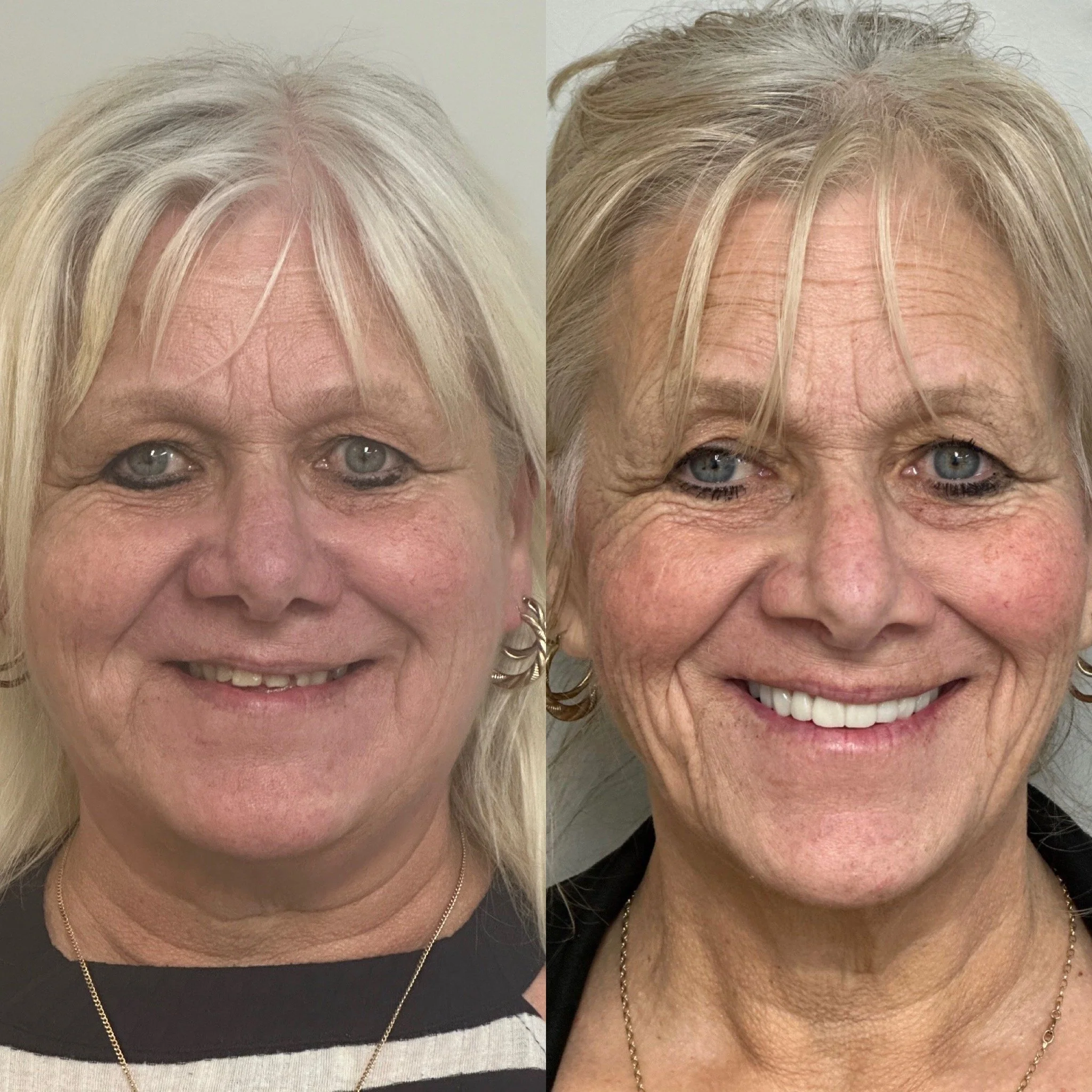 "Life changing, and certainly brought back my smile"