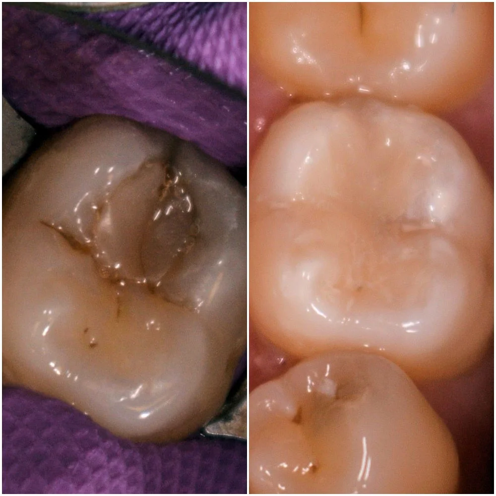 before after.jpg
