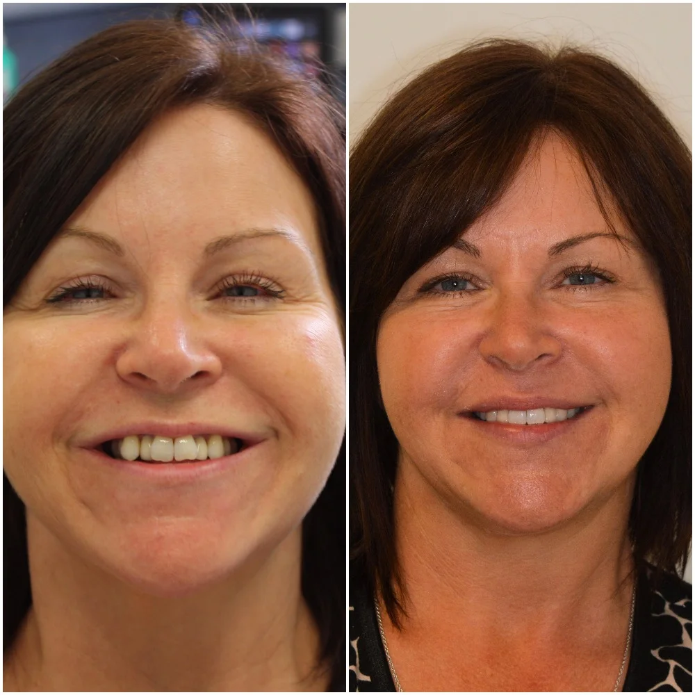 KC before-after full face.jpg