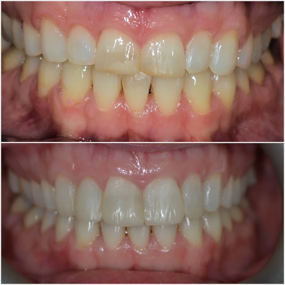CG post ortho comps 1.jpg