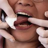 Plymouth, MN Dentist Oral Cancer Screenings