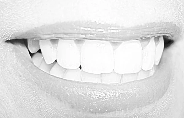 Sealant Services Plymouth, MN Dentist