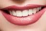 teeth-whitening-plymouth-mn.jpg