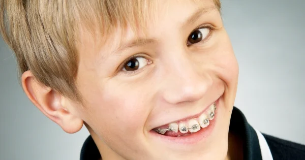 Braces-for-children-check-plymouth-dentist.jpg