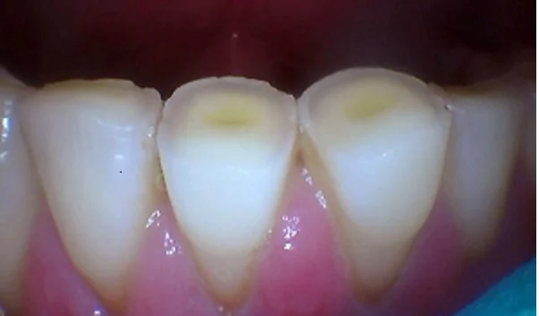Dental