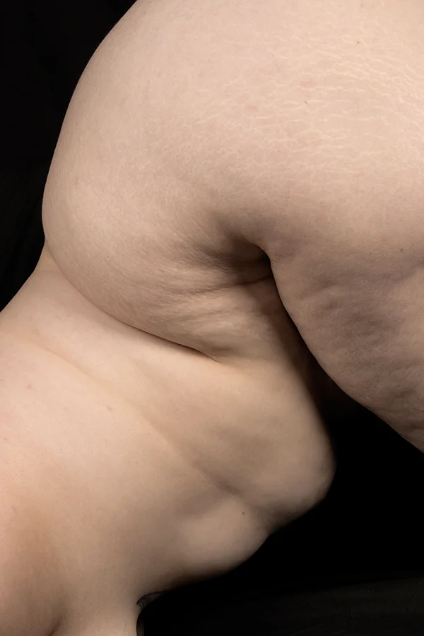 rose leg.jpg