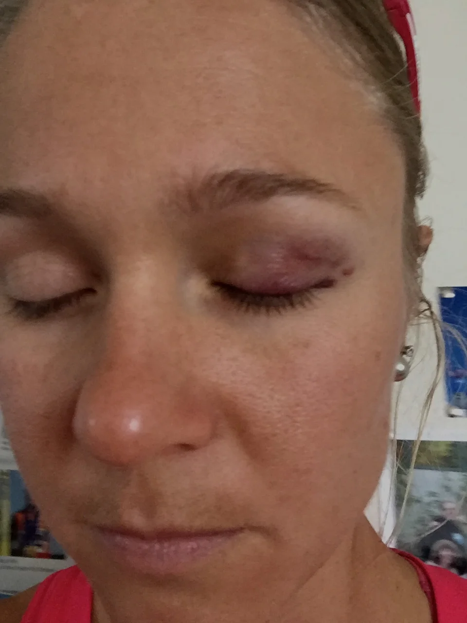 ouch!!