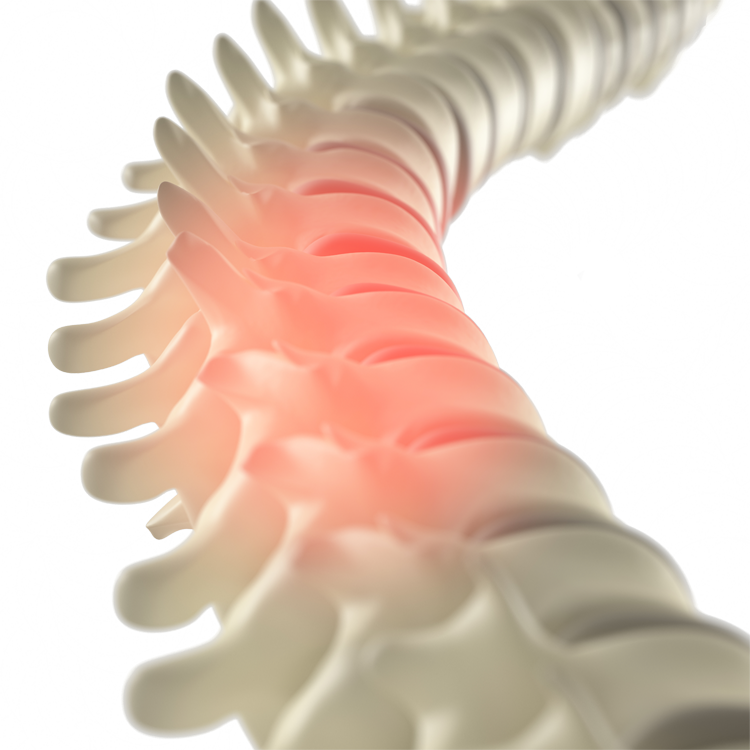 Spine