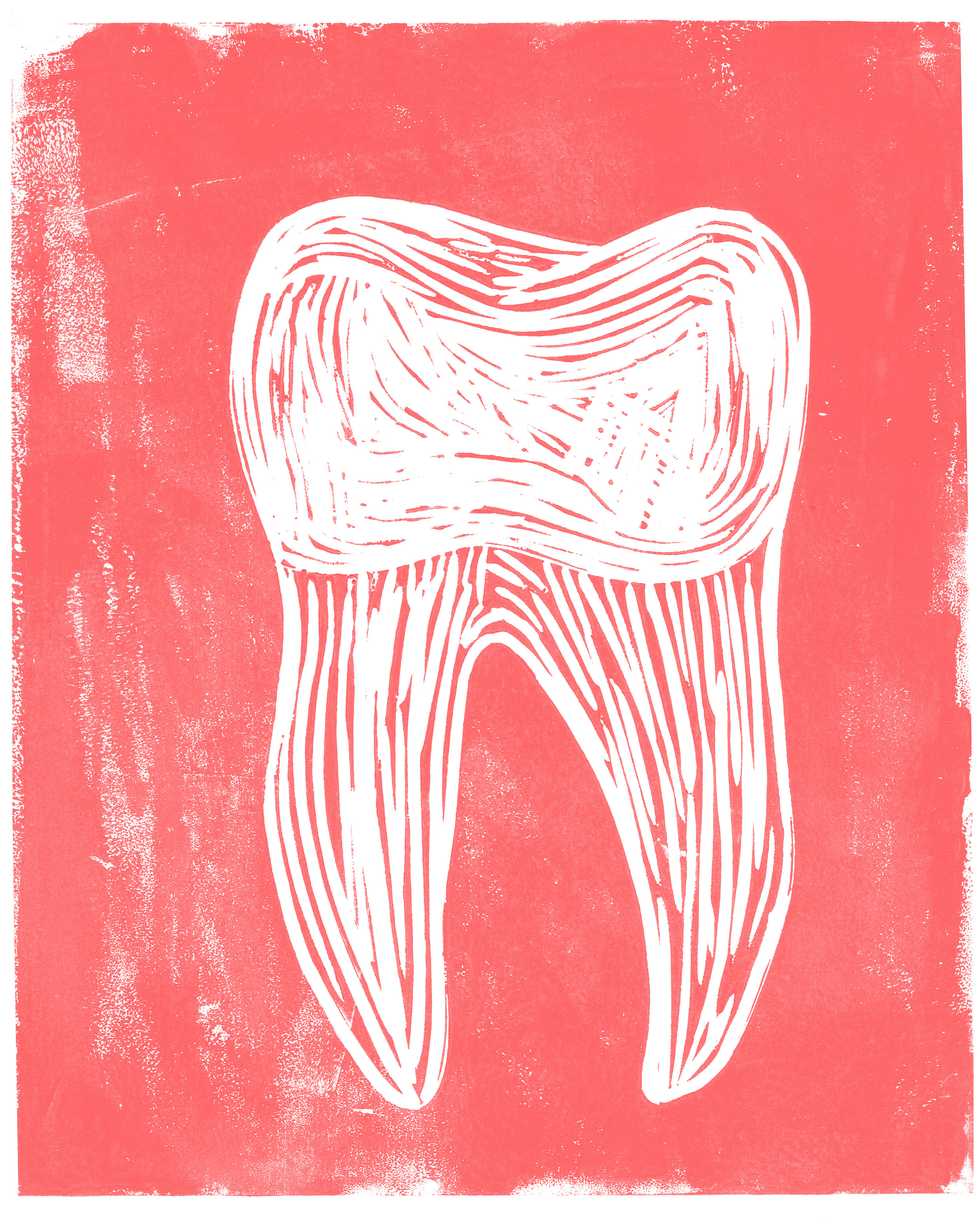 Tooth & Nail