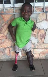 221 legs provided to amputees around the world.