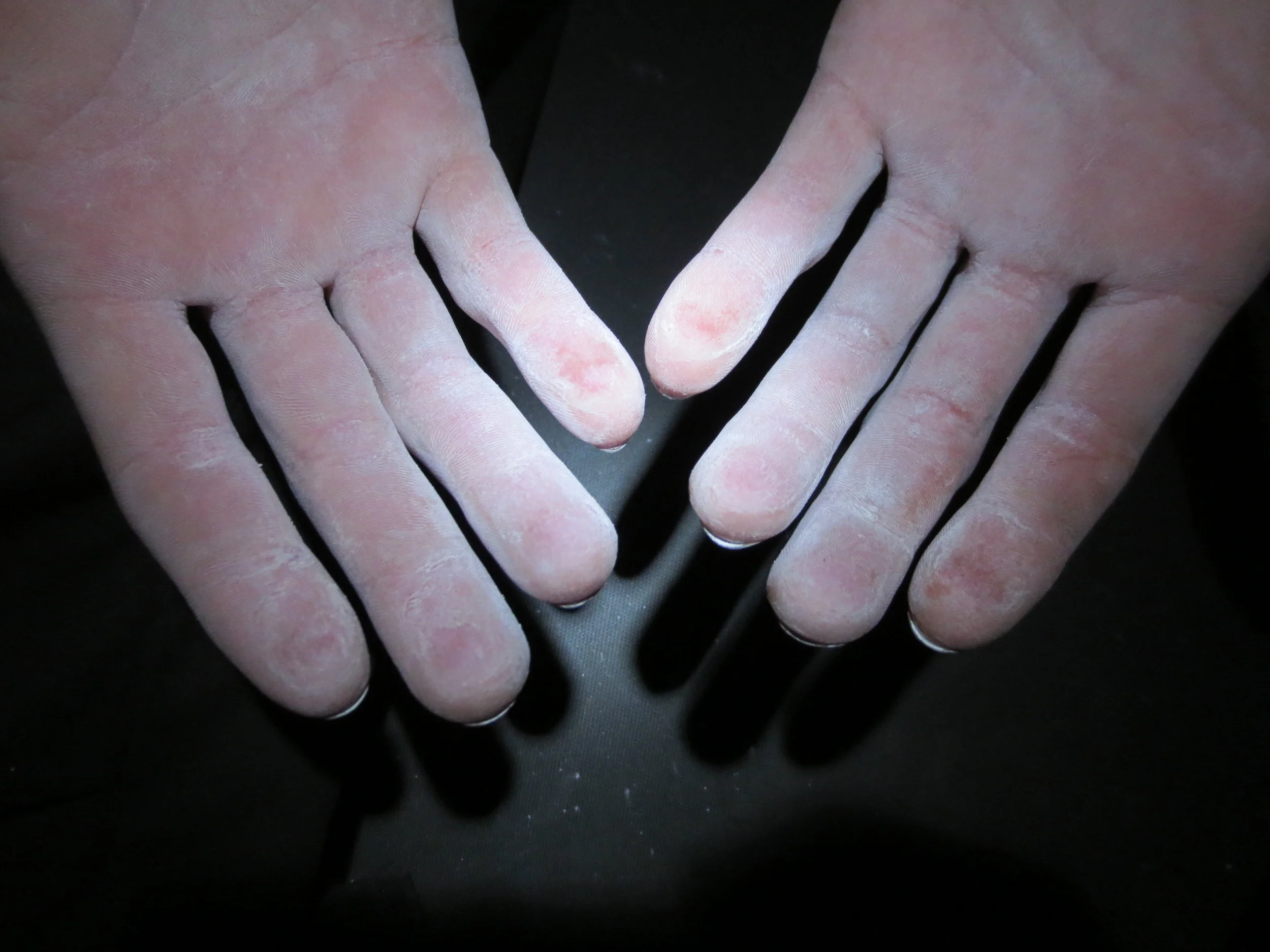 Ways to make more of your climbing session Hands — Climbing Clinic