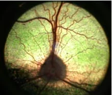normalcanineretina.jpg