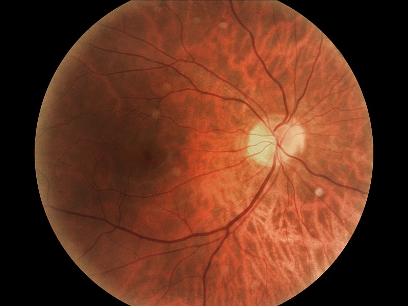 human retina.jpg