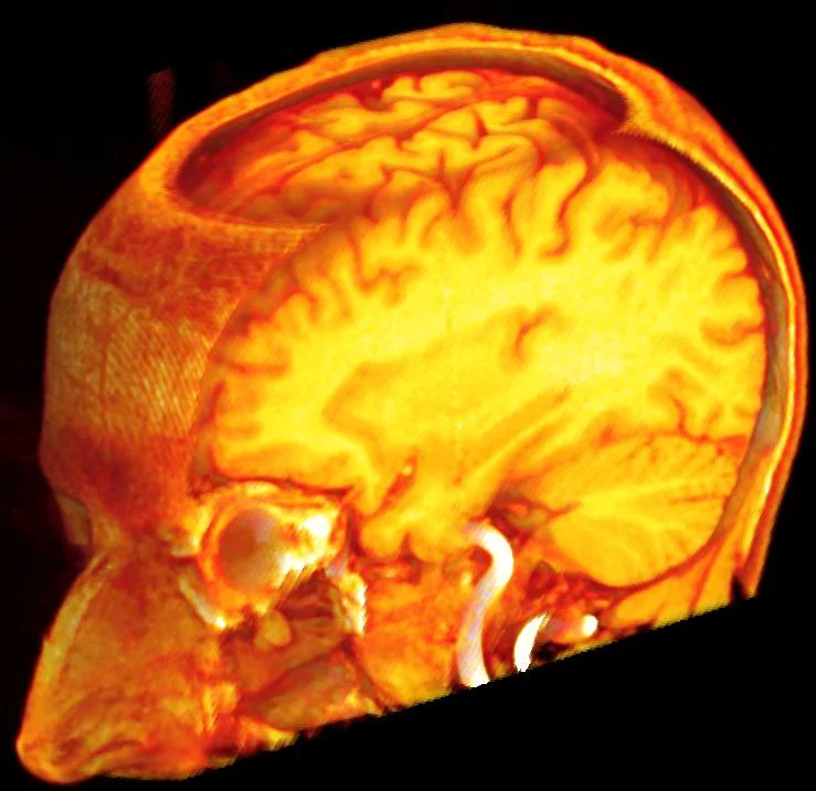 11a3c53344f5-XaqsBrain1.jpg