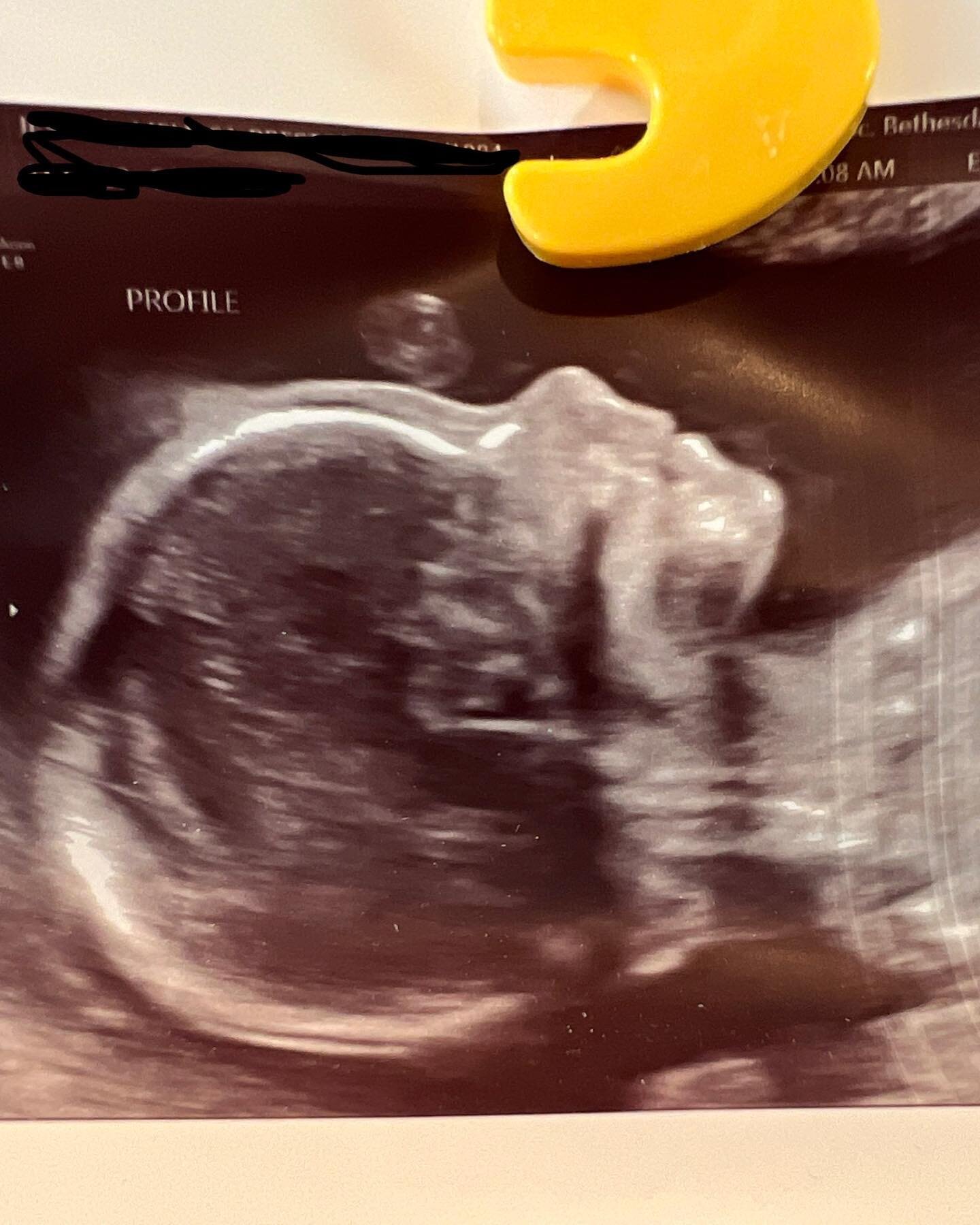 Meet my little lightbulb, my 22 week papaya. They&rsquo;ll be arriving early February and Eric, Bodhi, and I are feeling their love already.💗🥰👶😍🤟🚼❤️