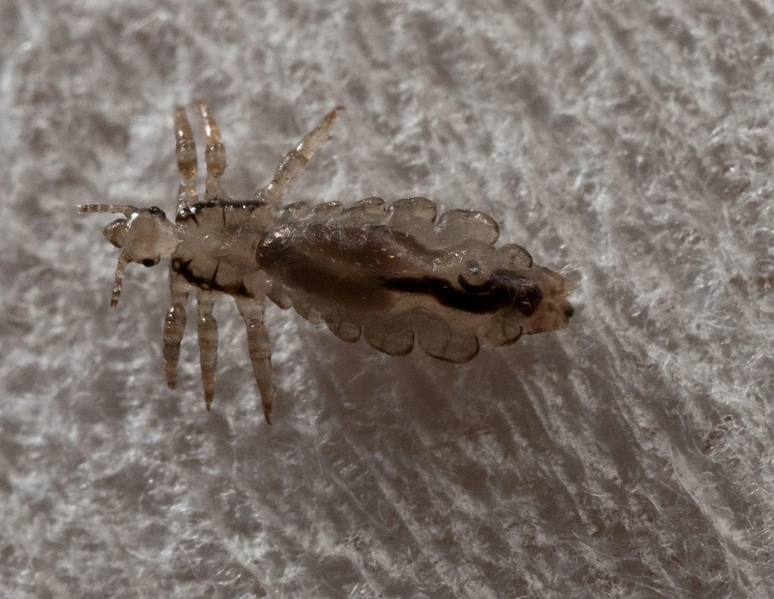 Head-louse_20110703_Herne_Bay_NZ_1.jpg