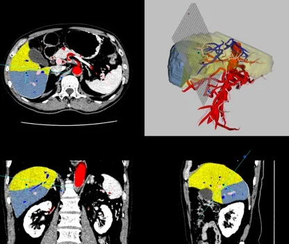 5-4-liver5.jpg